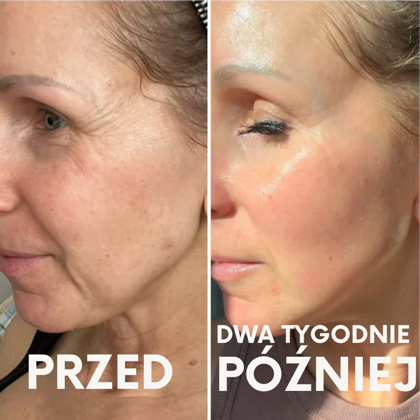 Shot z retinalem Fiorea – pożegnaj zmarszczki!